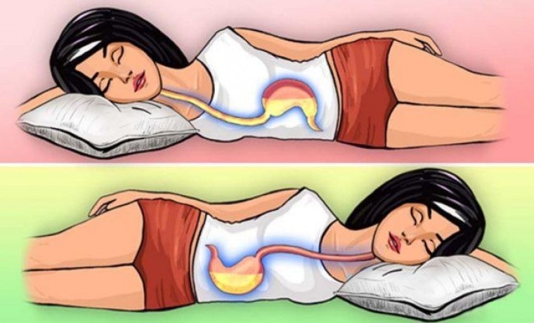 Se você dorme do lado esquerdo de cada noite, isso é o que acontece. O surpreendente! 2 Se você dorme do lado esquerdo de cada noite, isso é o que acontece. O surpreendente!